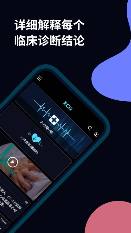 心电图ECG-全球心电图病例库图解