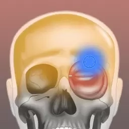 肌肉激痛点图谱-人体肌肉解剖图谱