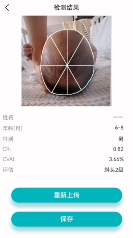 StarBaby头形分析软件