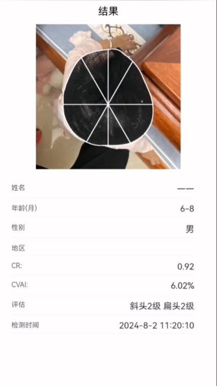 StarBaby头形分析软件