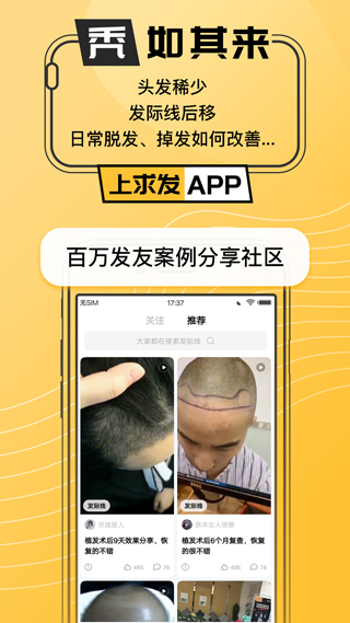 求发app图1
