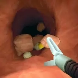 爱心诊所-大肠的复仇